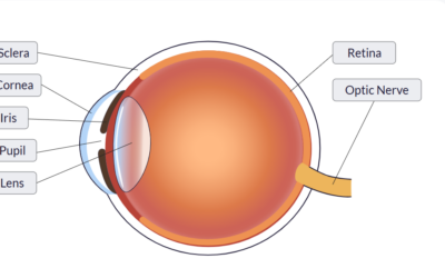 Tell me about cataracts